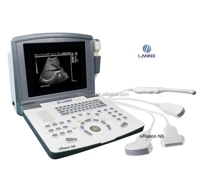 LANNX uRason N6 Medical Ultrasound Instruments ecografia portatil Portable 2D electric black and white ultrasound